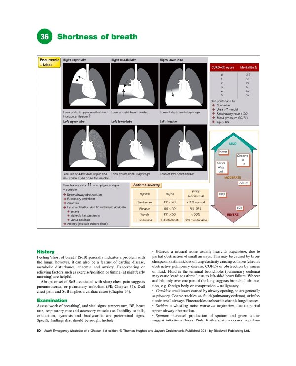 ˼ҽѧһ(Adult Emergency Medicine At a Glance)Ӣְ[PDF]